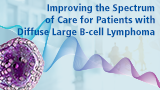 Improving the Spectrum of Care for Patients with Diffuse Large B-cell Lymphoma